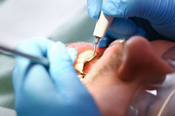 Best Emergency Treatment for Toothache in Somers Point, NJ